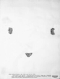 Lecanographa lyncea image